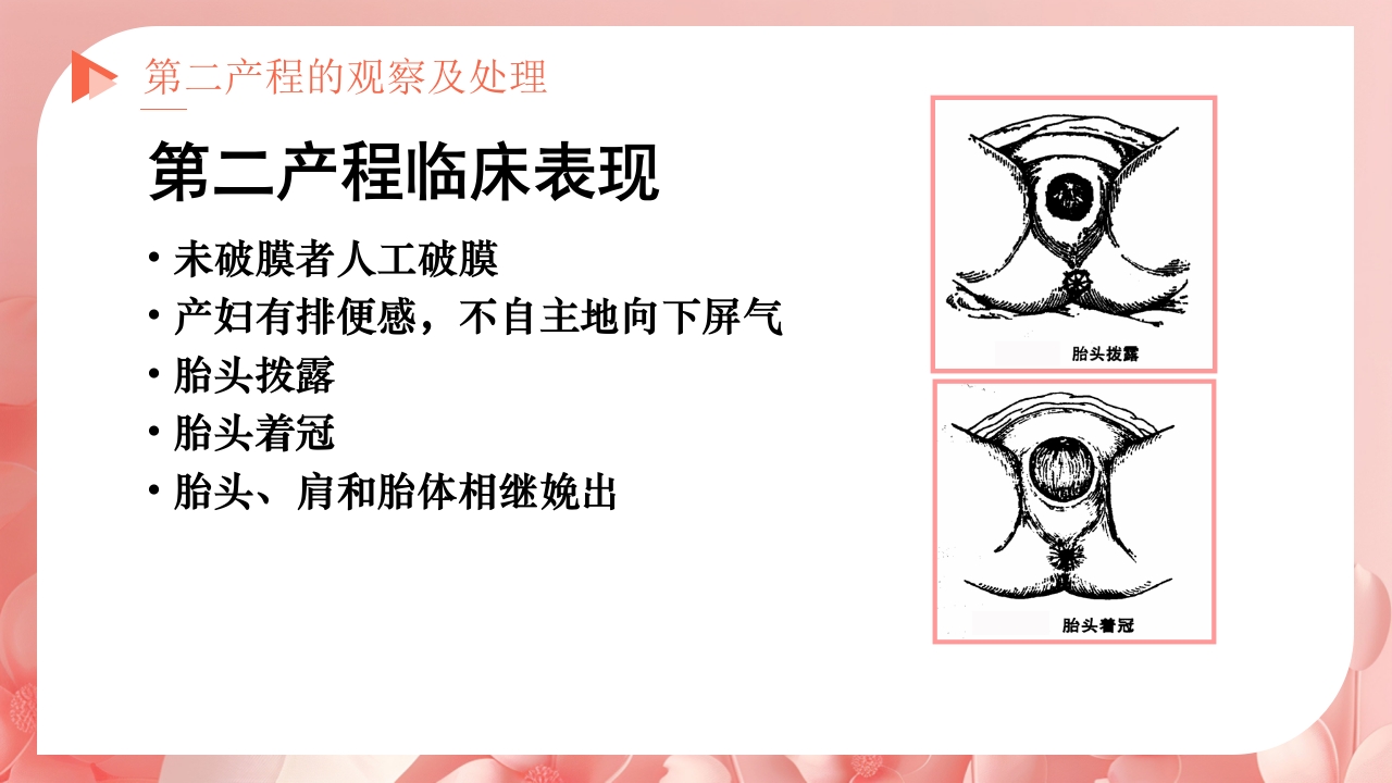 产程的观察及处理ppt课件17