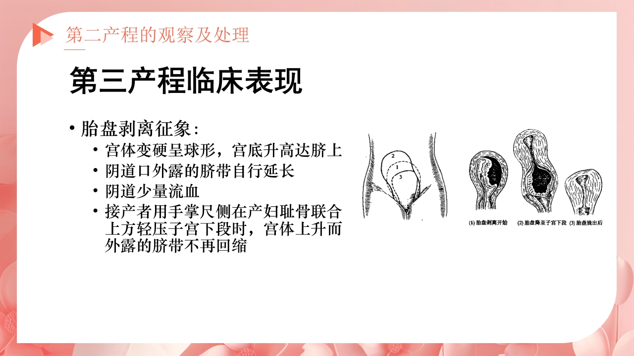 产程的观察及处理ppt课件22