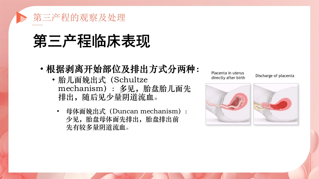 产程的观察及处理ppt课件23