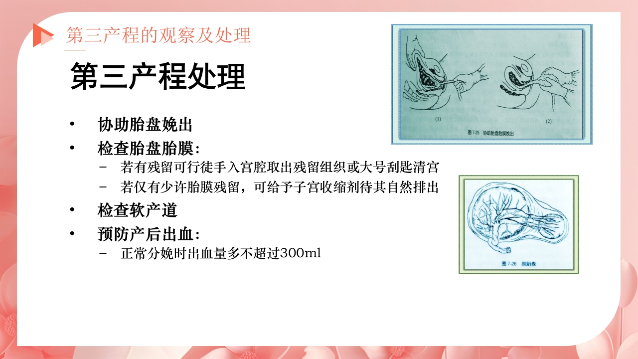 产程的观察及处理ppt课件26