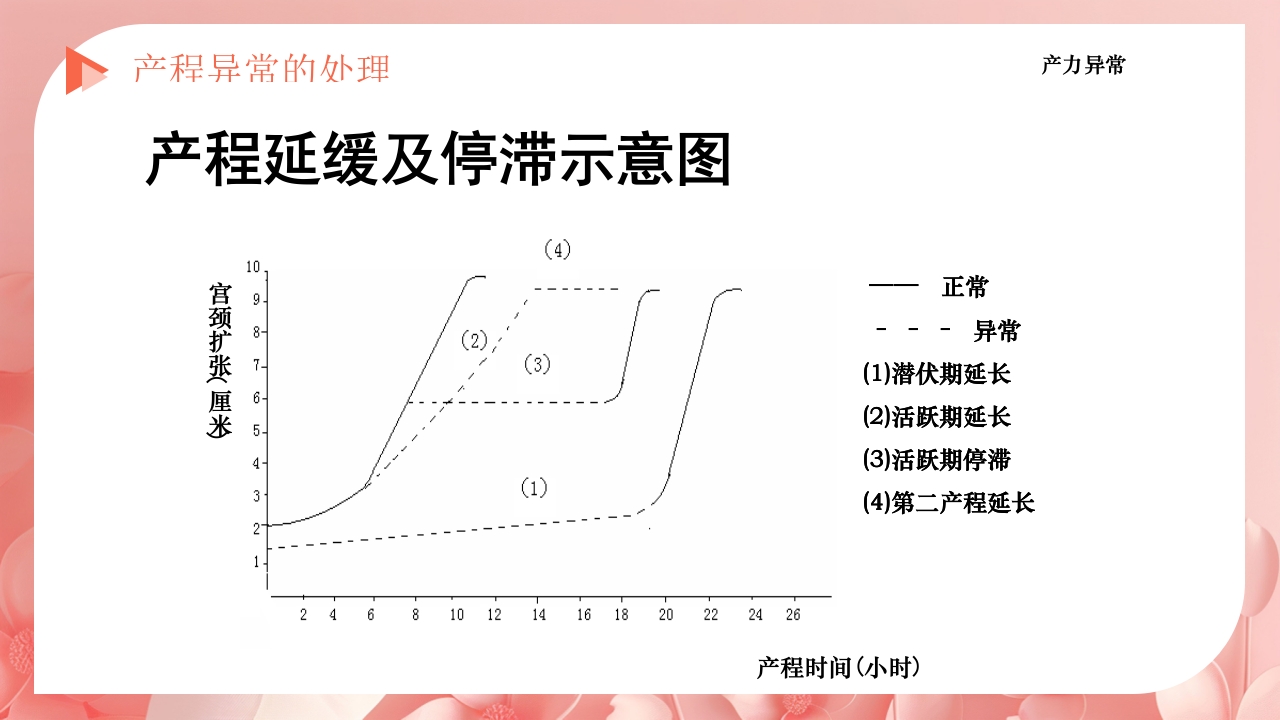 产程的观察及处理ppt课件31