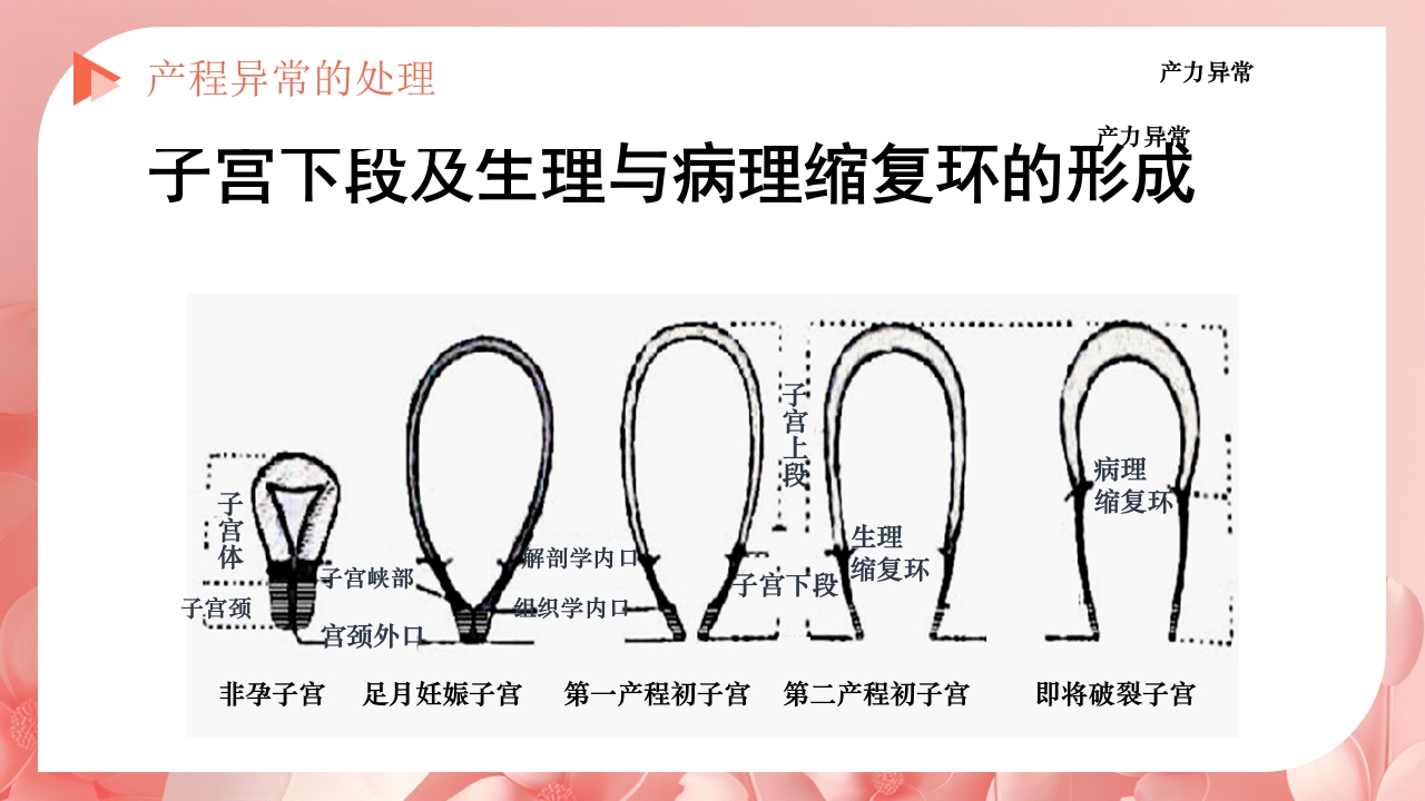 产程的观察及处理ppt课件41