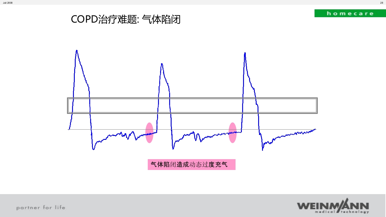 万曼无创呼吸机操作VENTImotion-2操作ppt课件28