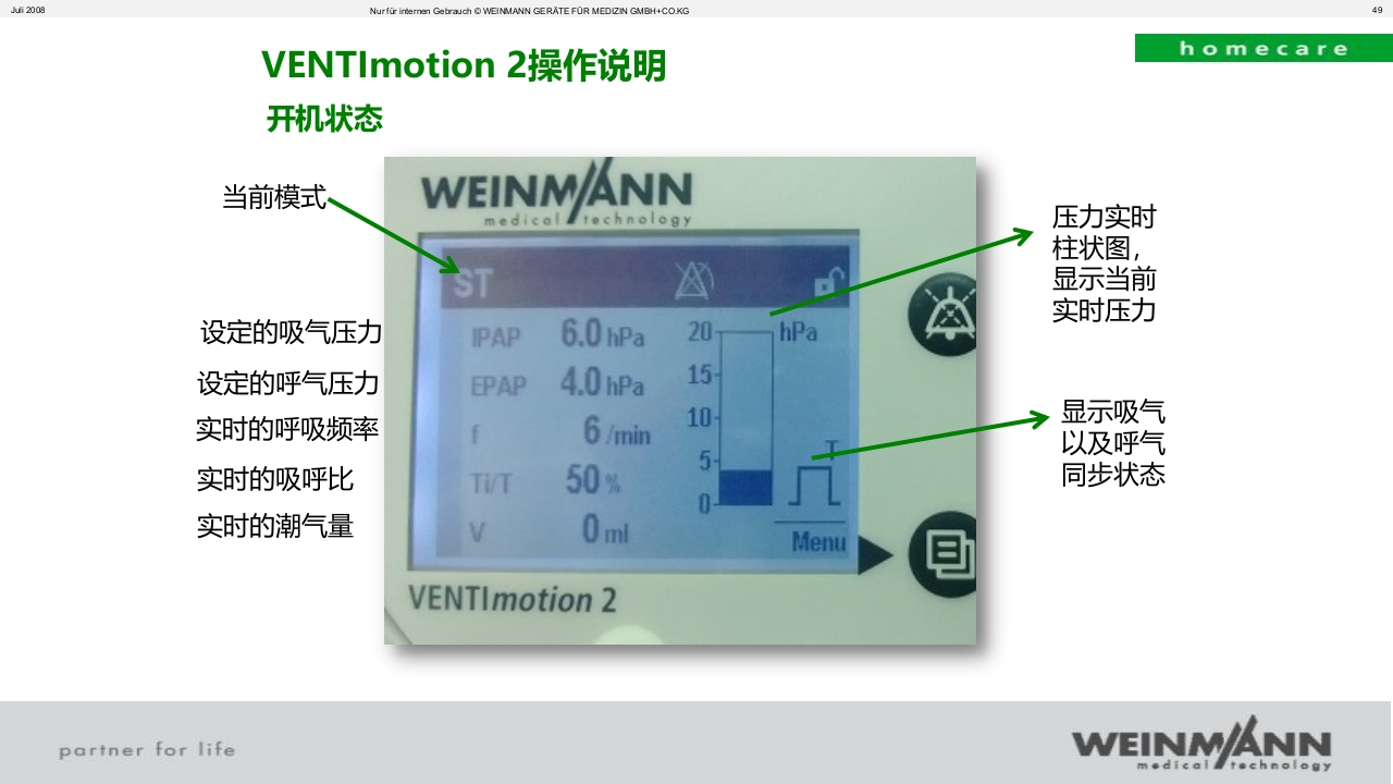 万曼无创呼吸机操作VENTImotion-2操作ppt课件49