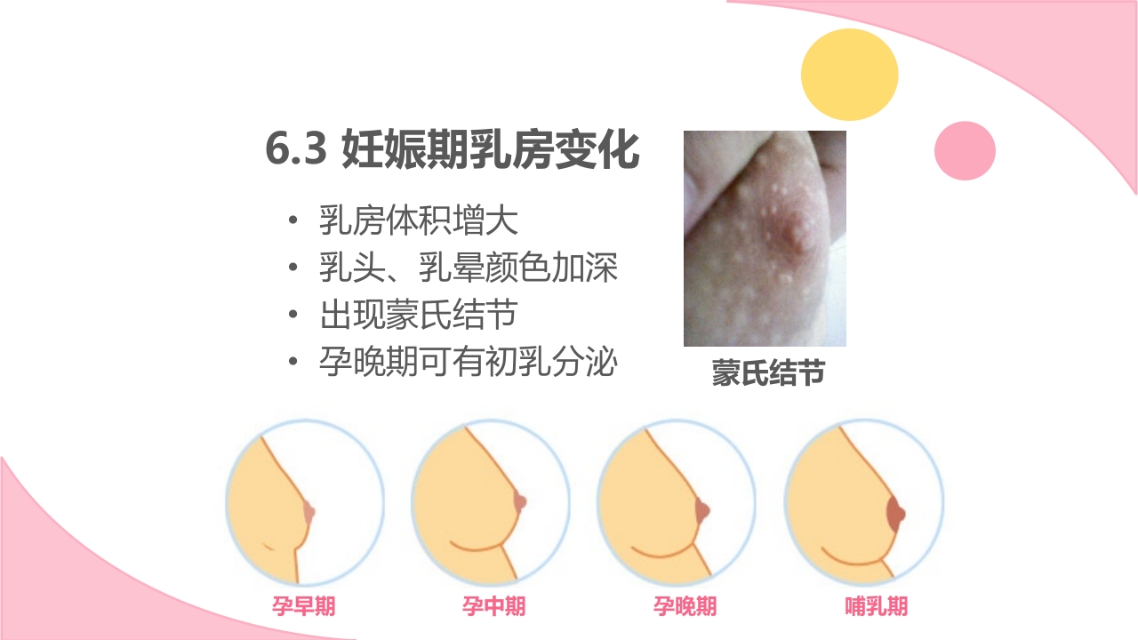 孕期常见不适及处理方法ppt课件35