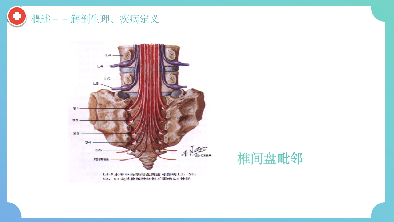 腰椎间盘突出症围手术期护理及康复锻炼PPT课件6
