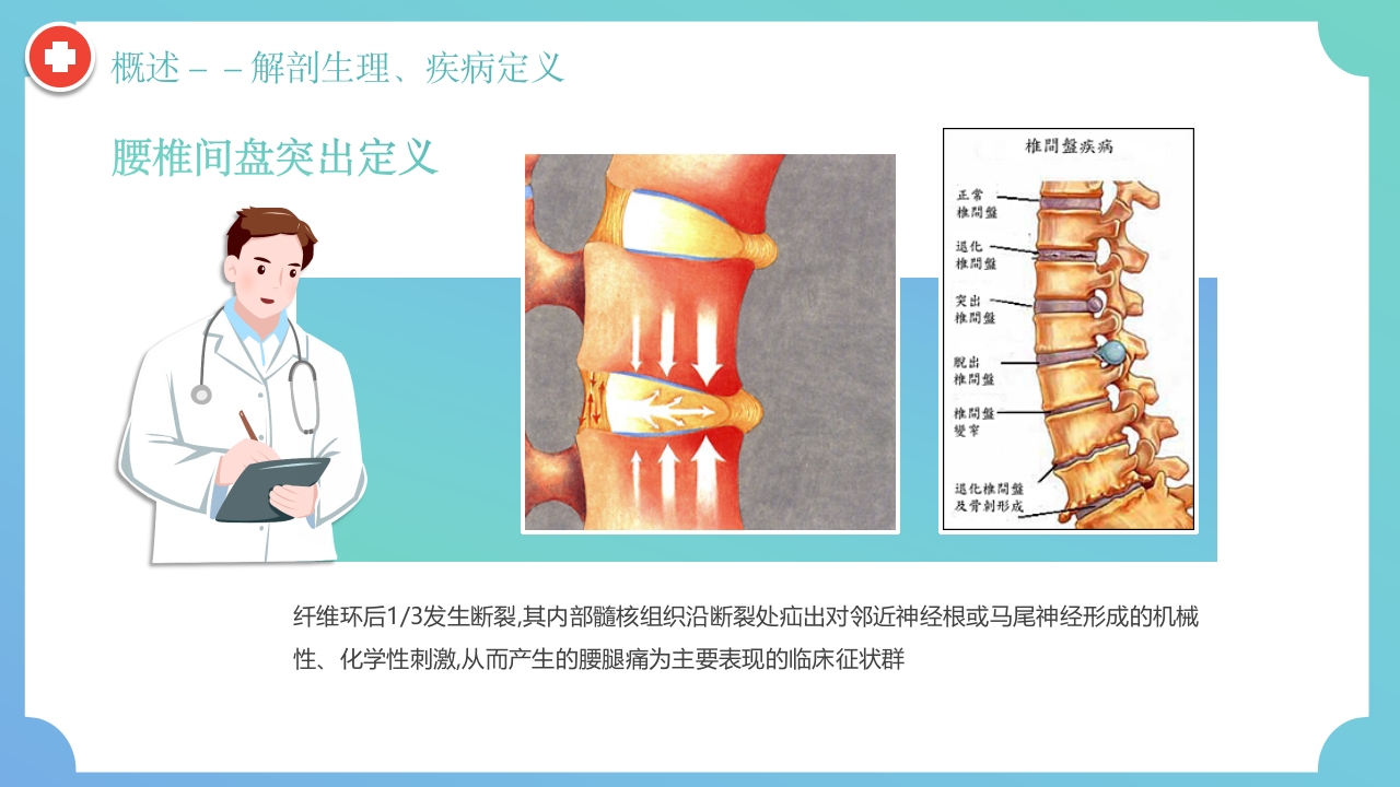 腰椎间盘突出症围手术期护理及康复锻炼PPT课件7