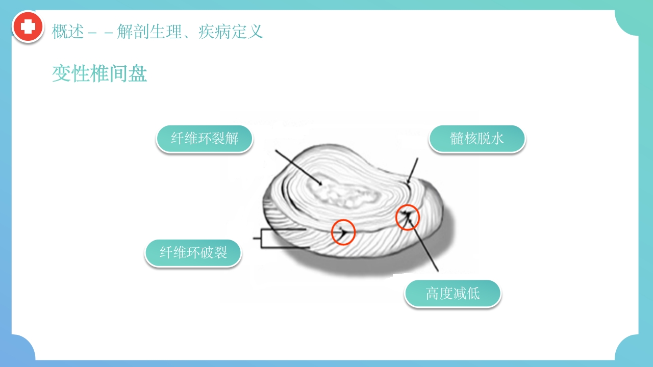 腰椎间盘突出症围手术期护理及康复锻炼PPT课件9