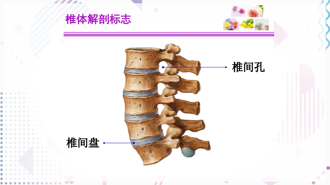 脊柱侧弯手术治疗ppt课件7