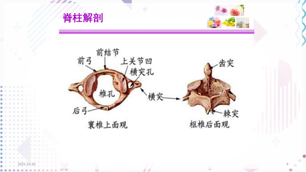 脊柱侧弯手术治疗ppt课件9