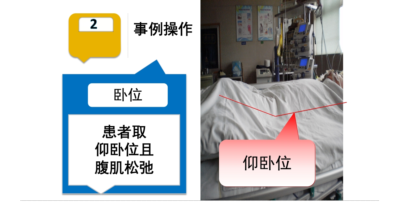 腹内压监测新方法ppt课件10