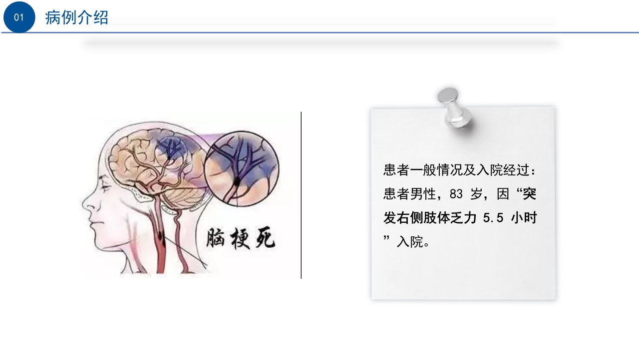 一例急性脑梗死患者行动脉支架取栓的术后护理PPT课件4