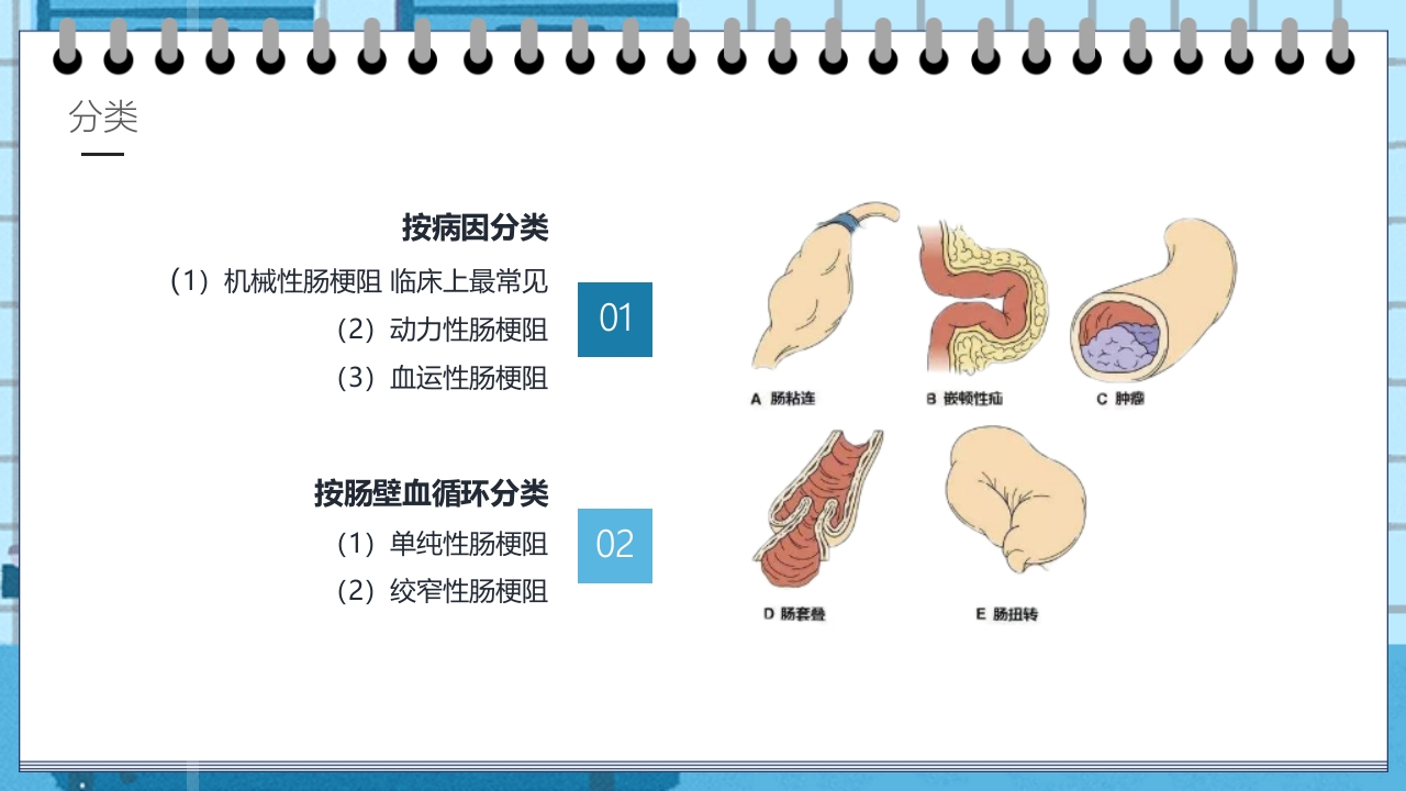 肠梗阻的护理业务学习教学PPT课件6
