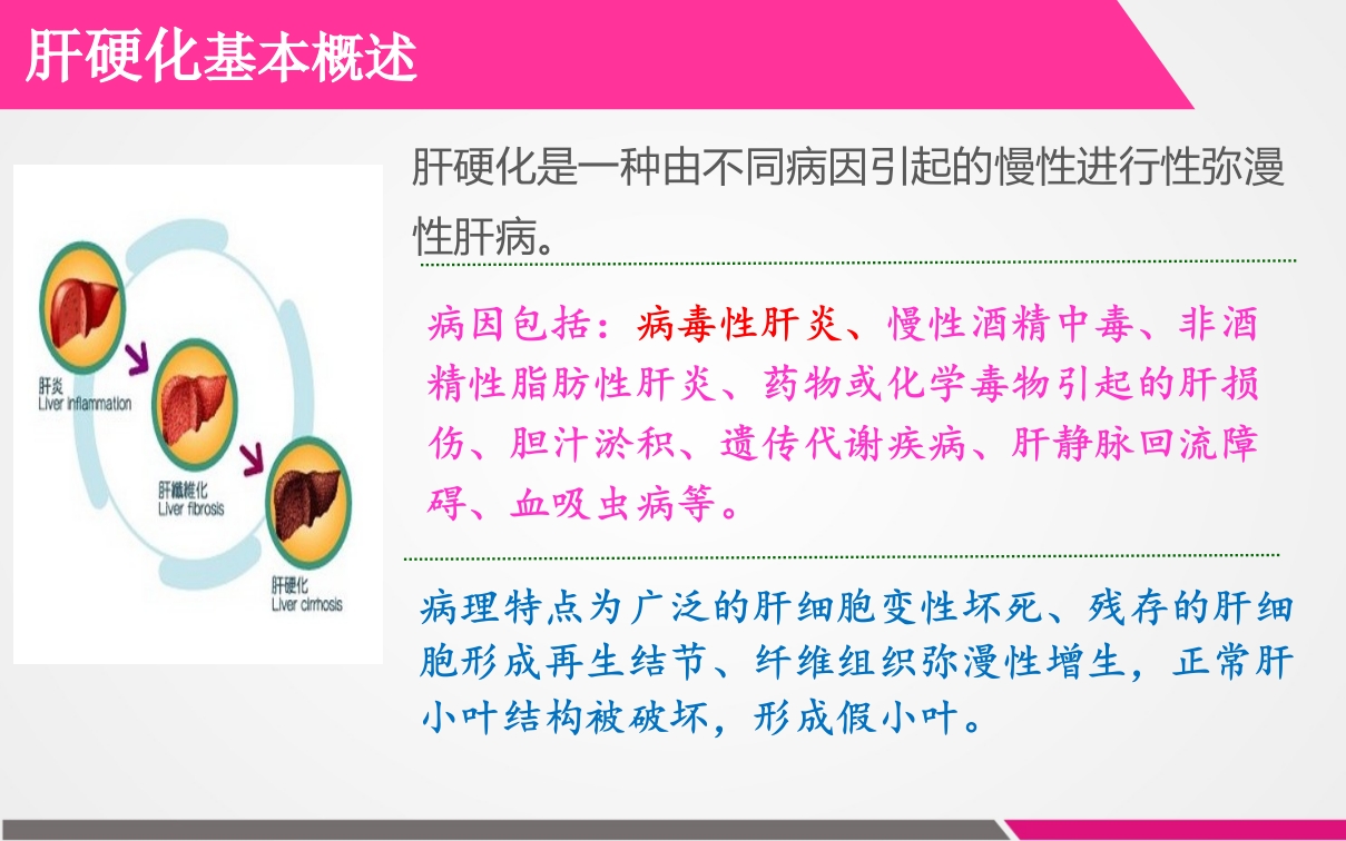 肝硬化失代偿期患者的护理查房ppt课件3