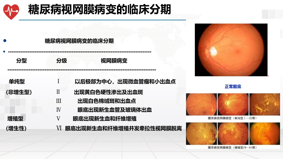 糖尿病性视网膜病变的护理ppt课件10