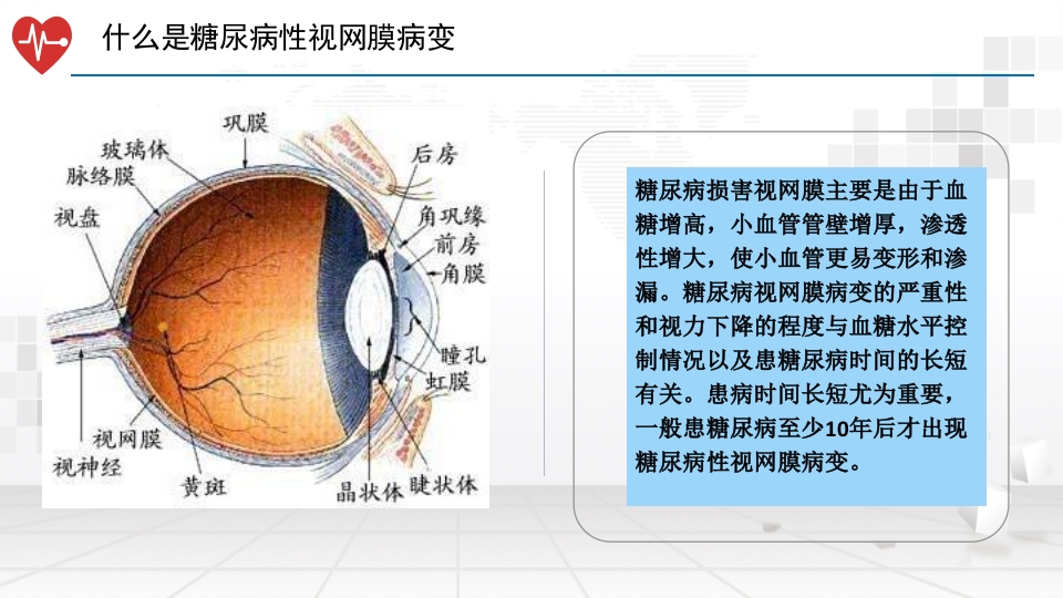 糖尿病性视网膜病变的护理ppt课件4
