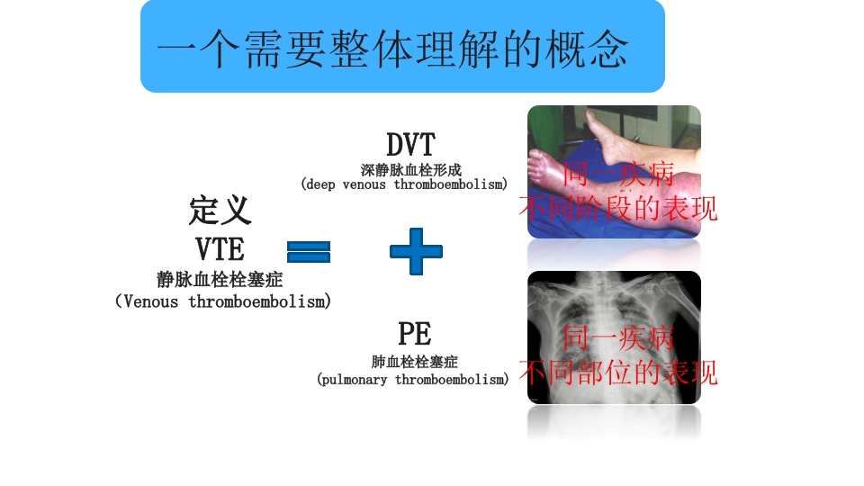 VTE的评估与预防ppt课件4