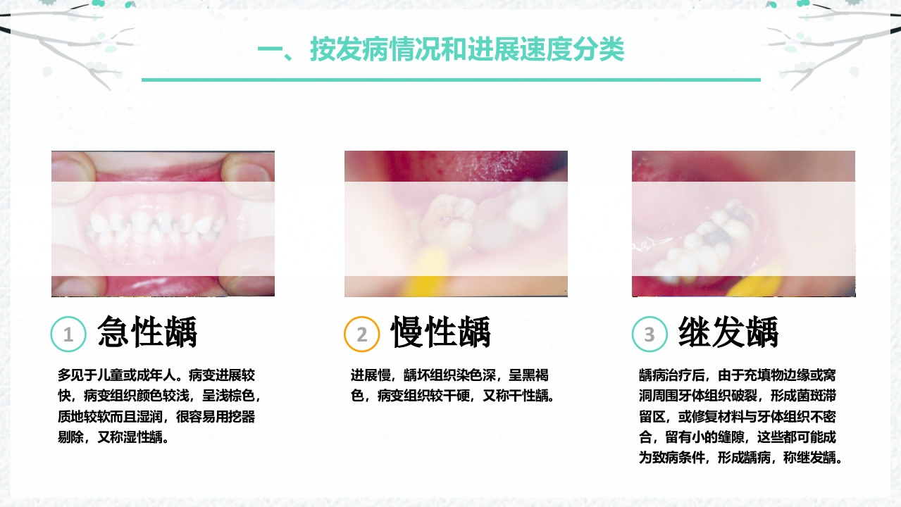 龋病的分类及充填治疗ppt课件4