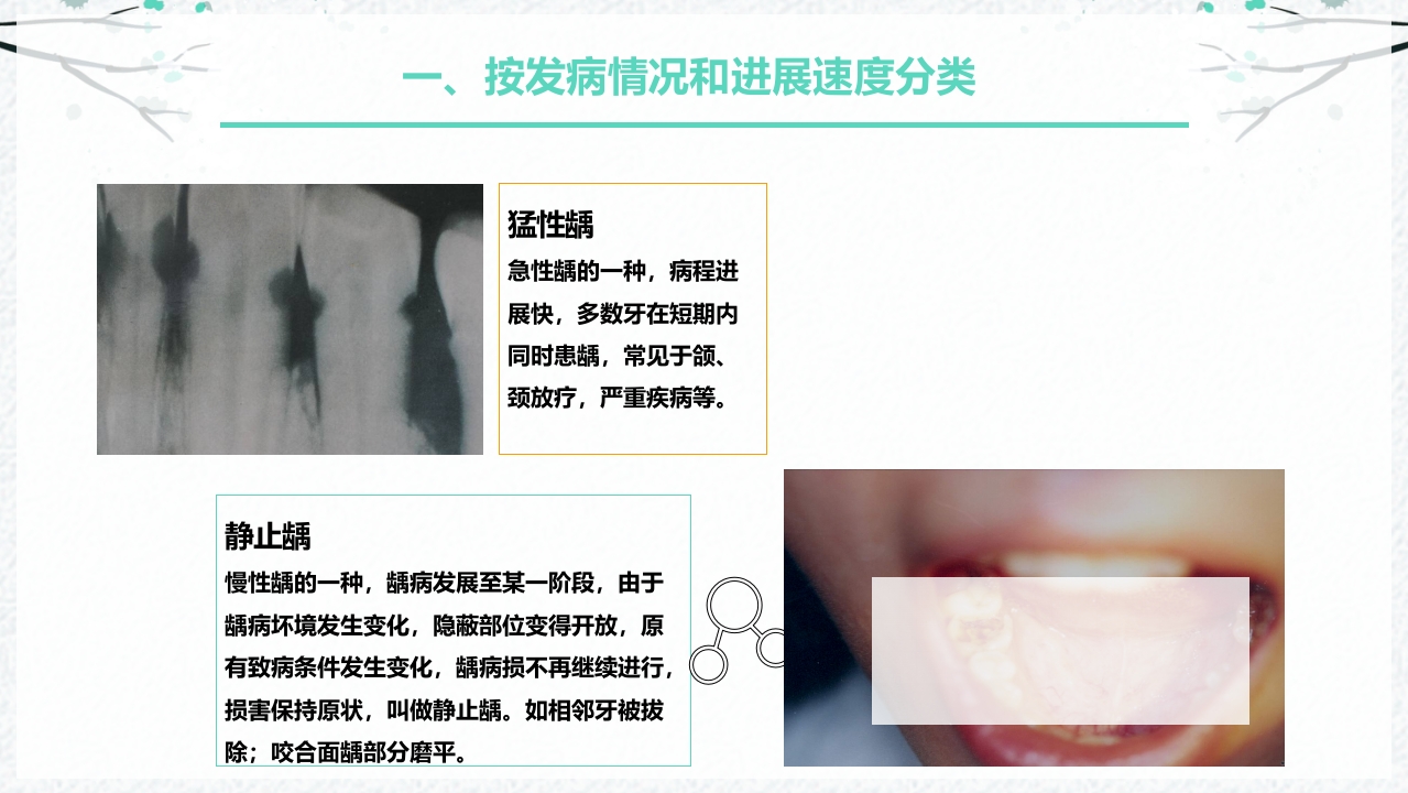 龋病的分类及充填治疗ppt课件5