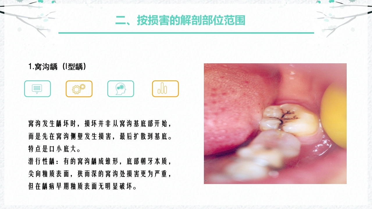 龋病的分类及充填治疗ppt课件6