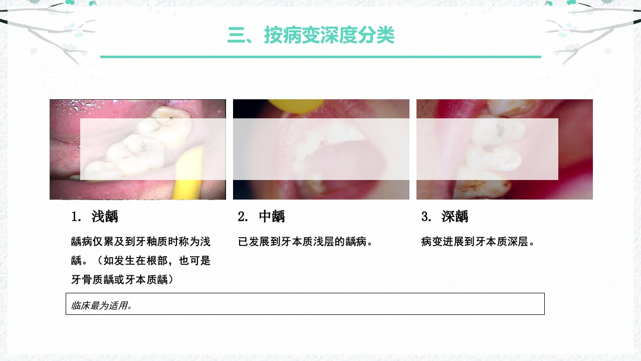 龋病的分类及充填治疗ppt课件9