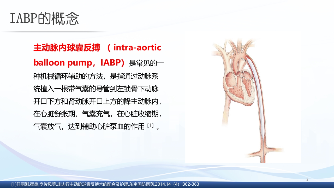 主动脉球囊反搏术(IABP)监测及护理ppt课件3