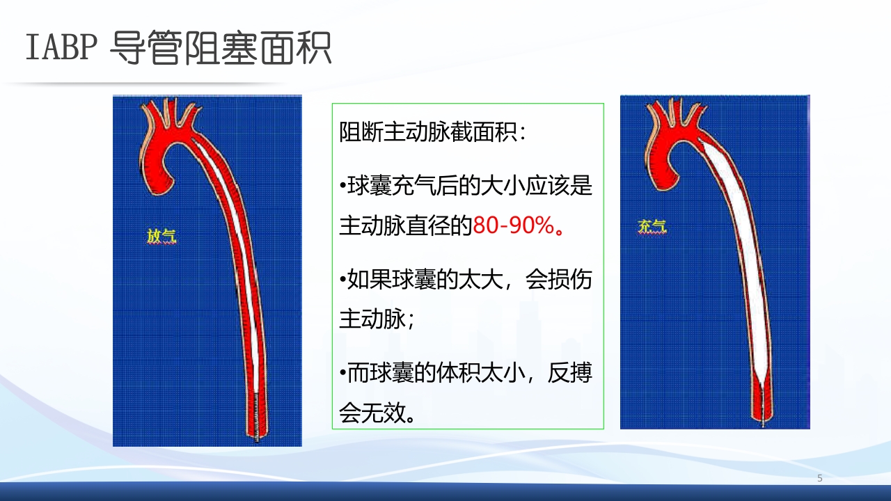 主动脉球囊反搏术(IABP)监测及护理ppt课件5