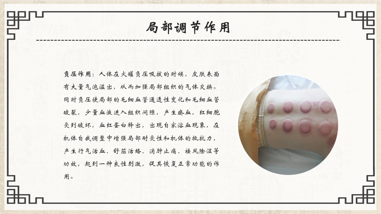 中医护理八大基本操作之一拔罐疗法PPT课件8