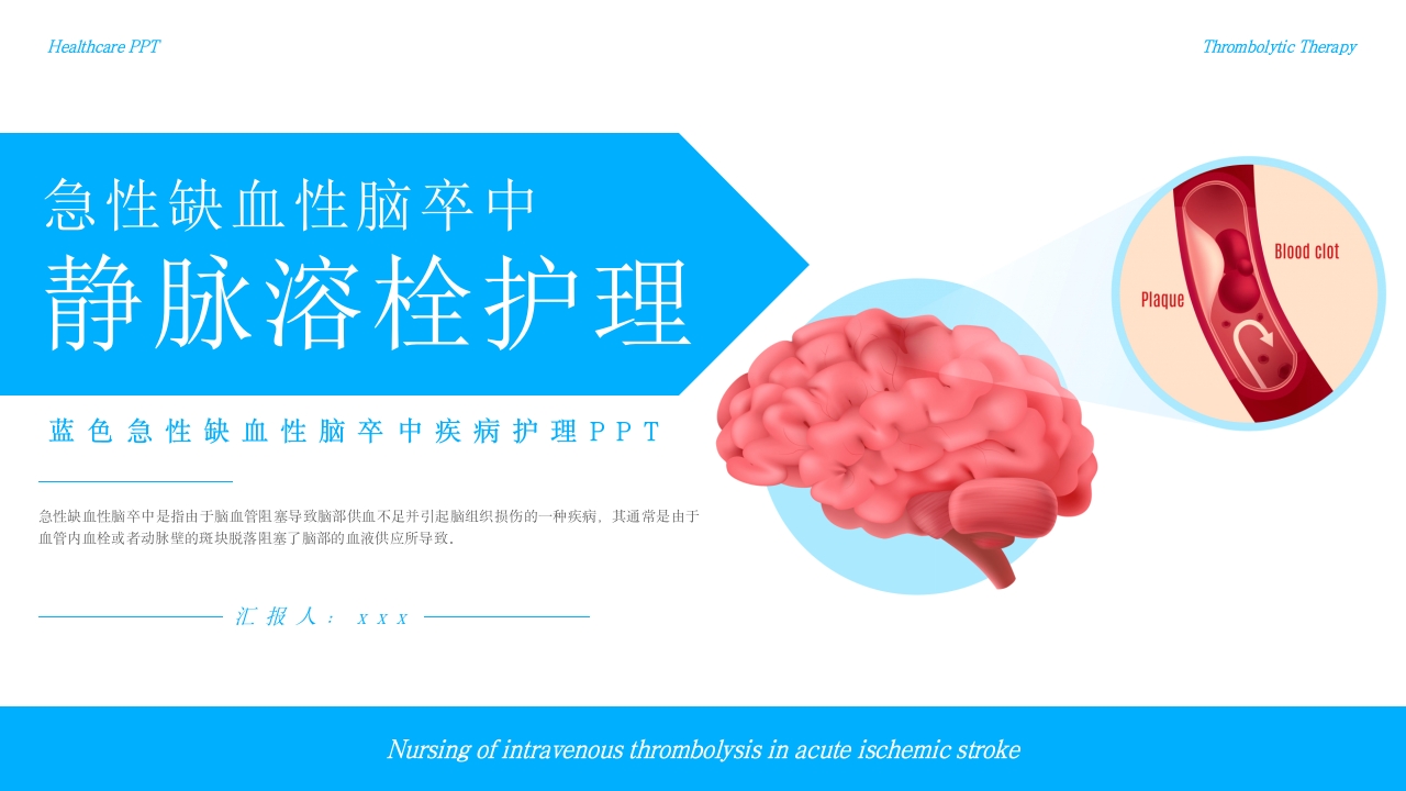 急性缺血性脑卒中静脉溶栓护理疾病护理护理查房PPT课件-压缩1