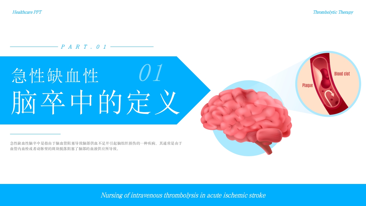 急性缺血性脑卒中静脉溶栓护理疾病护理护理查房PPT课件-压缩3