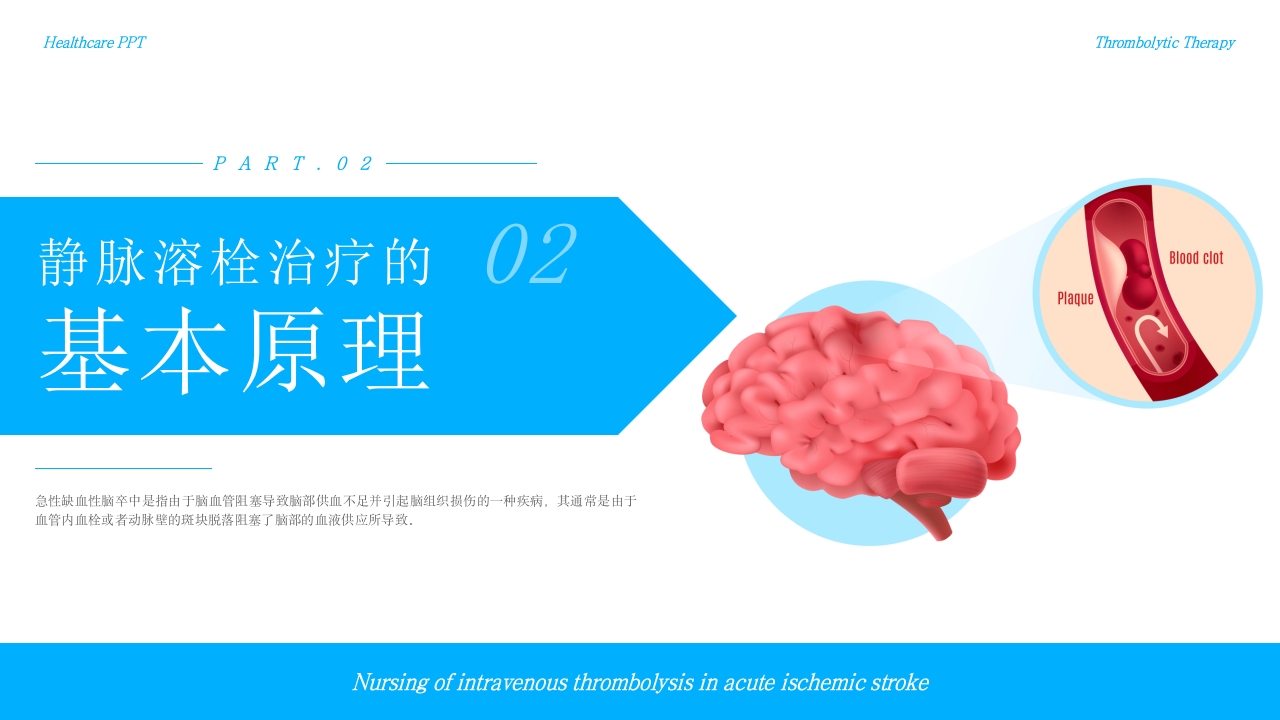 急性缺血性脑卒中静脉溶栓护理疾病护理护理查房PPT课件-压缩5