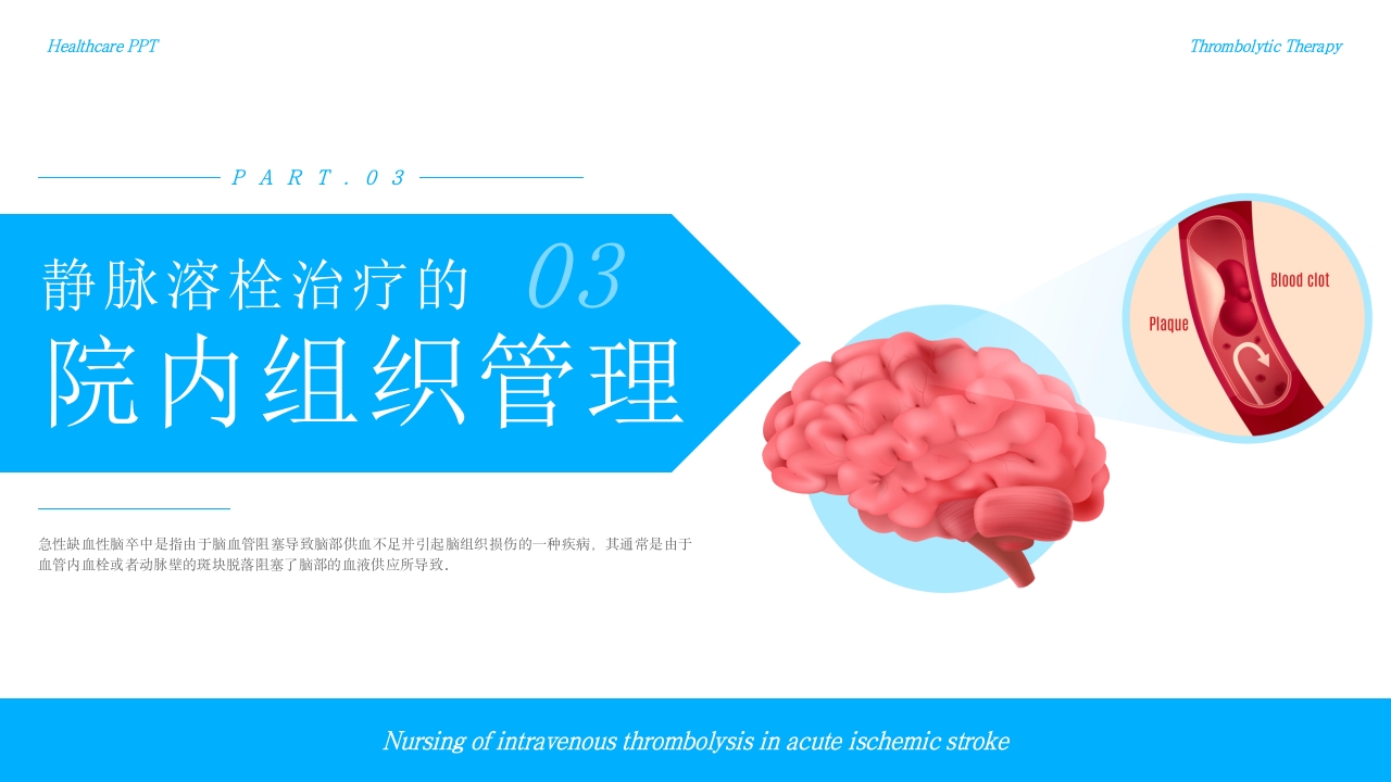 急性缺血性脑卒中静脉溶栓护理疾病护理护理查房PPT课件-压缩8