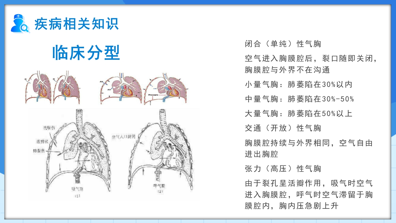 自发性气胸护理查房PPT课件7