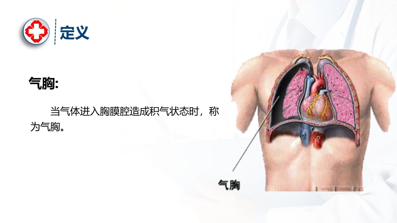 气胸的诊断及治疗ppt课件4