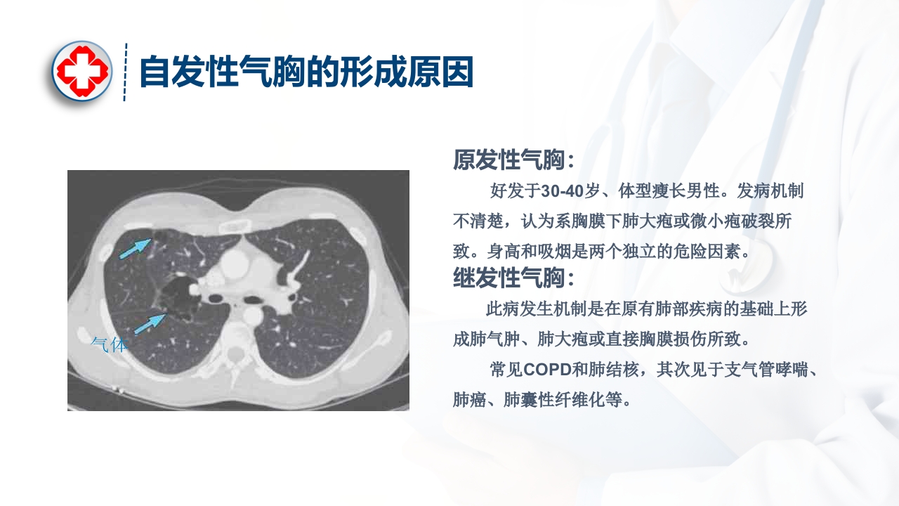 气胸的诊断及治疗ppt课件5