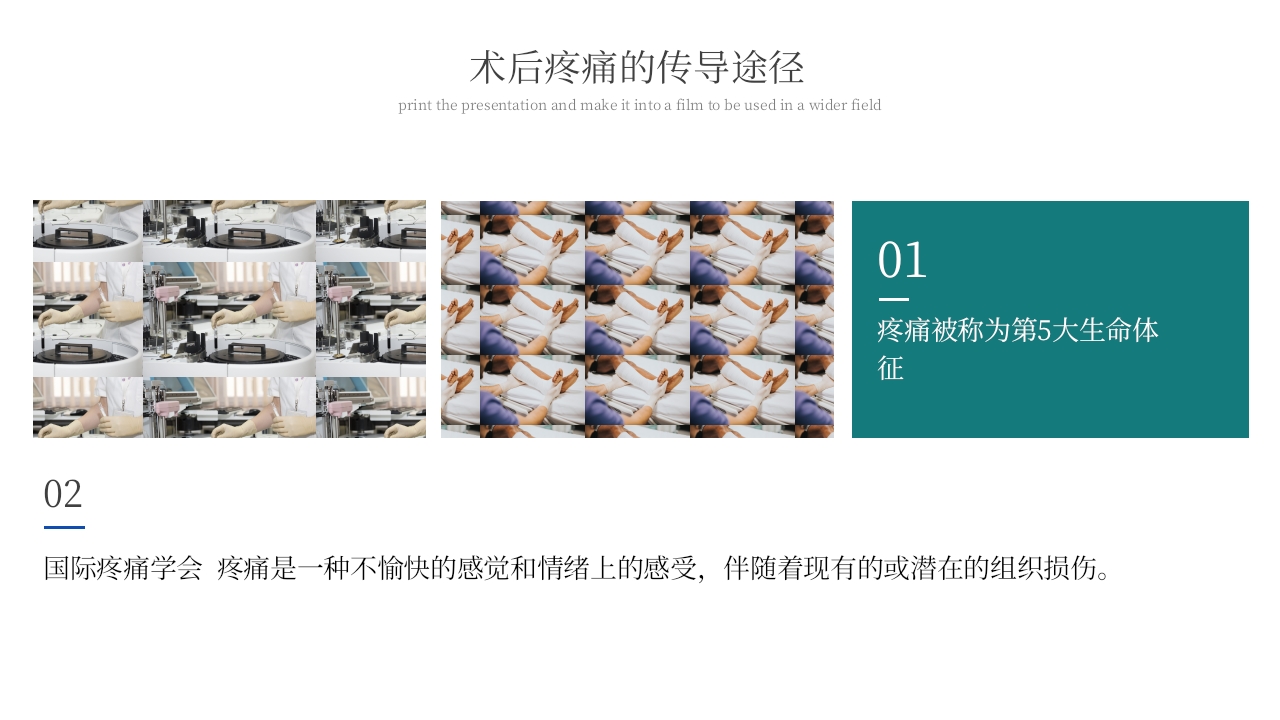 术后疼痛的护理PPT课件5