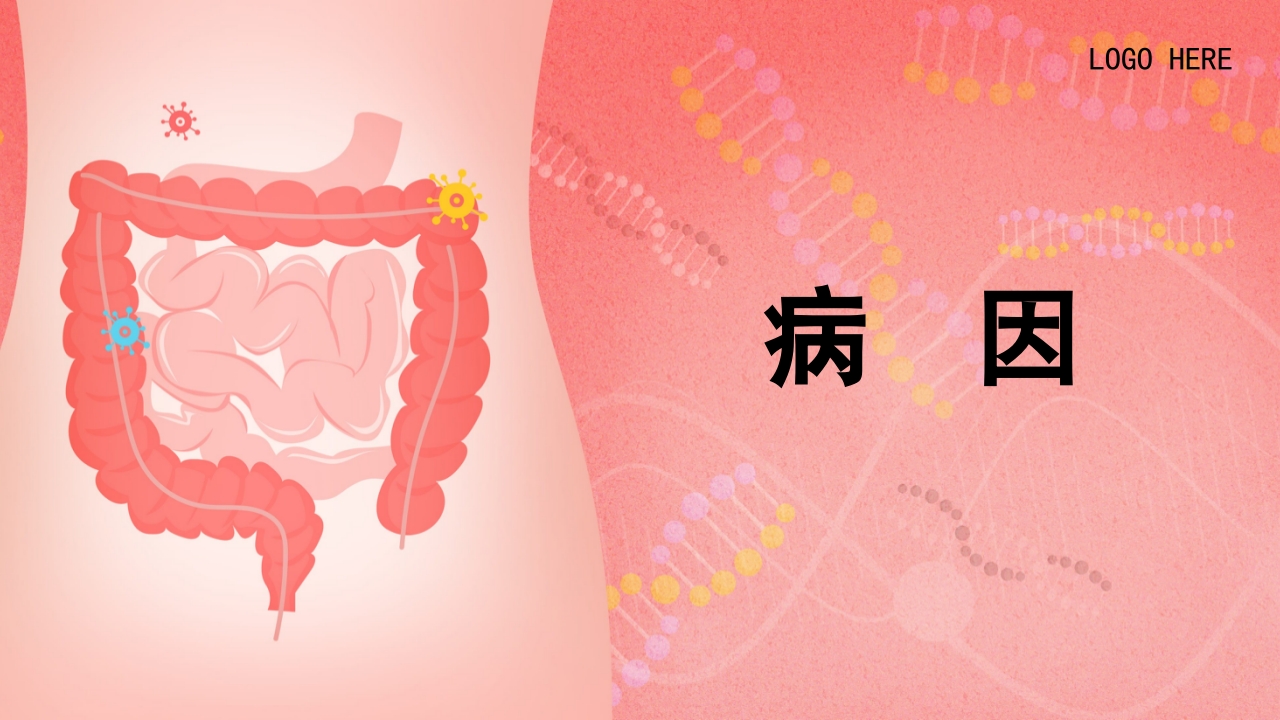 急性胰腺炎PPT课件9