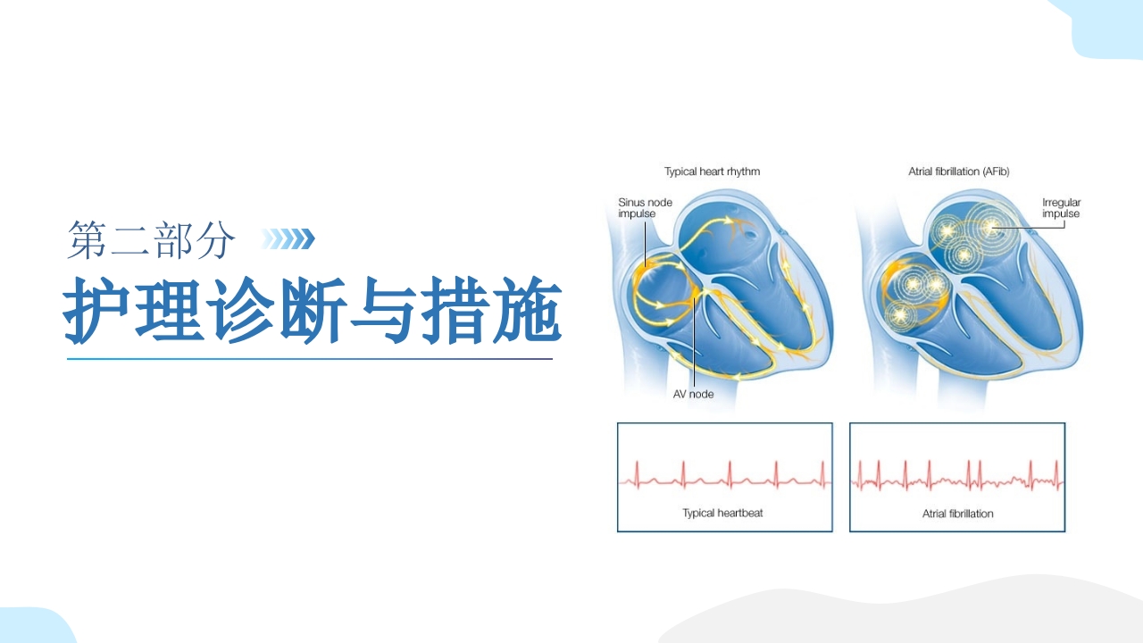 房颤患者护理查房PPT课件10