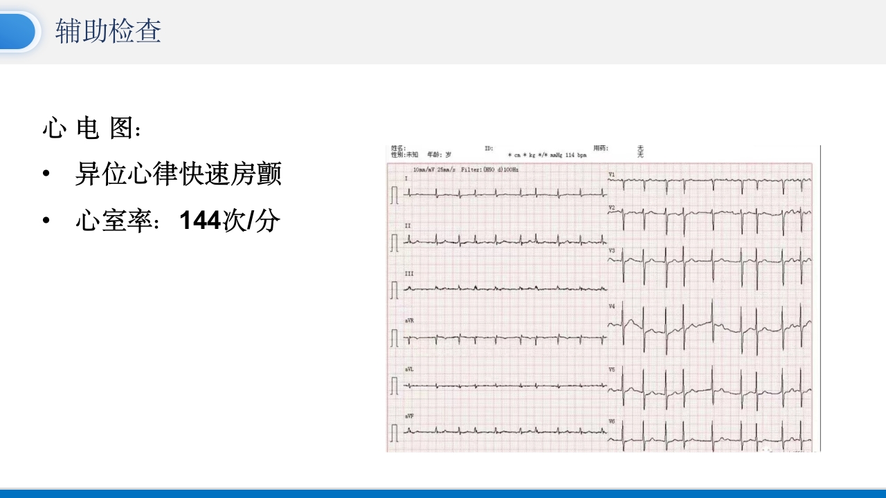 房颤患者护理查房PPT课件7