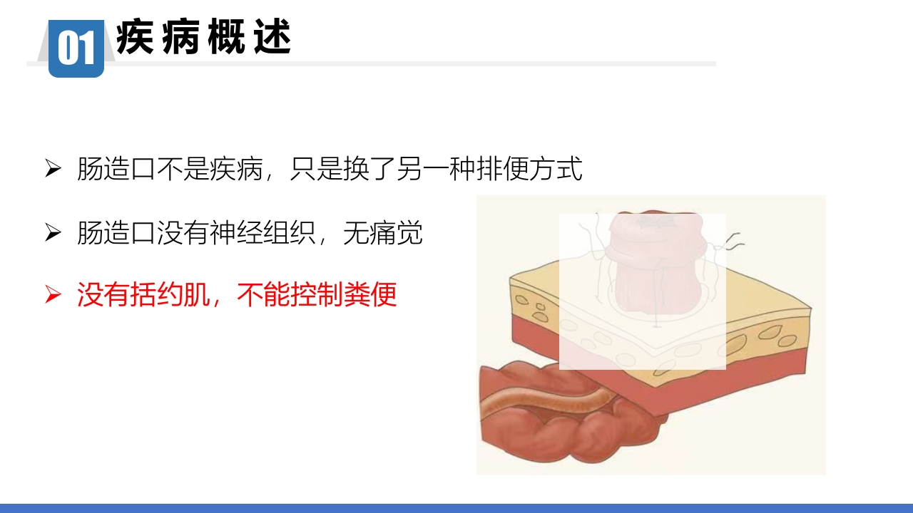 一例回肠造口周围皮肤粪水性皮炎患者的个案护理PPT课件8