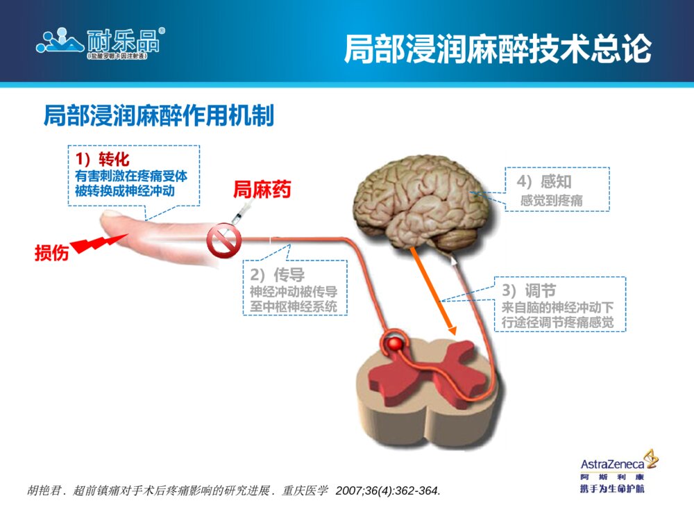 局部浸润麻醉技术操作指南腹部手术术后疼痛管理ppt课件9