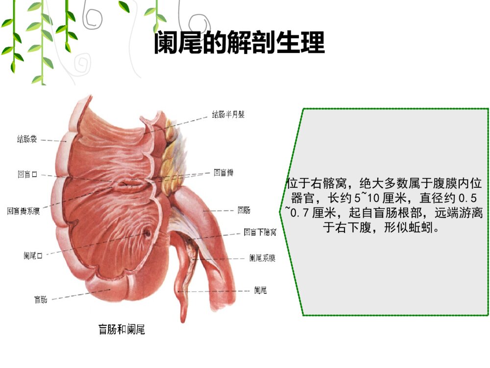 腹腔镜阑尾手术护理查房ppt课件3