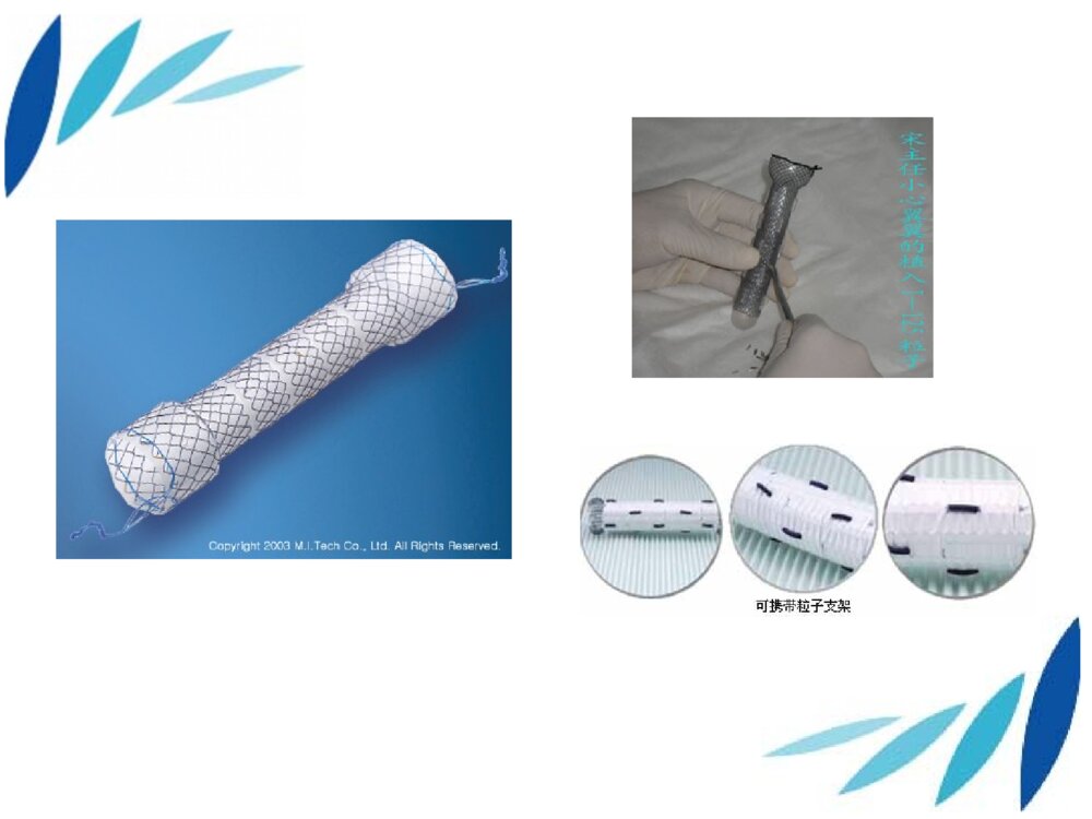 食管癌术后支架置入术后护理个案护理ppt课件7