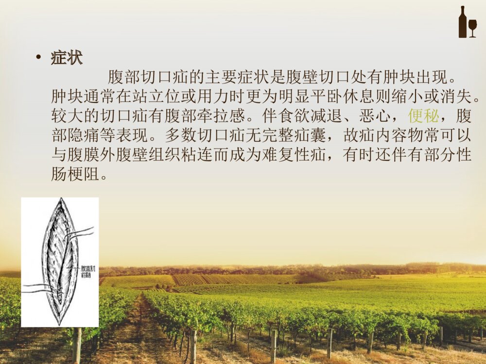 腹部切口疝的护理ppt课件下载7