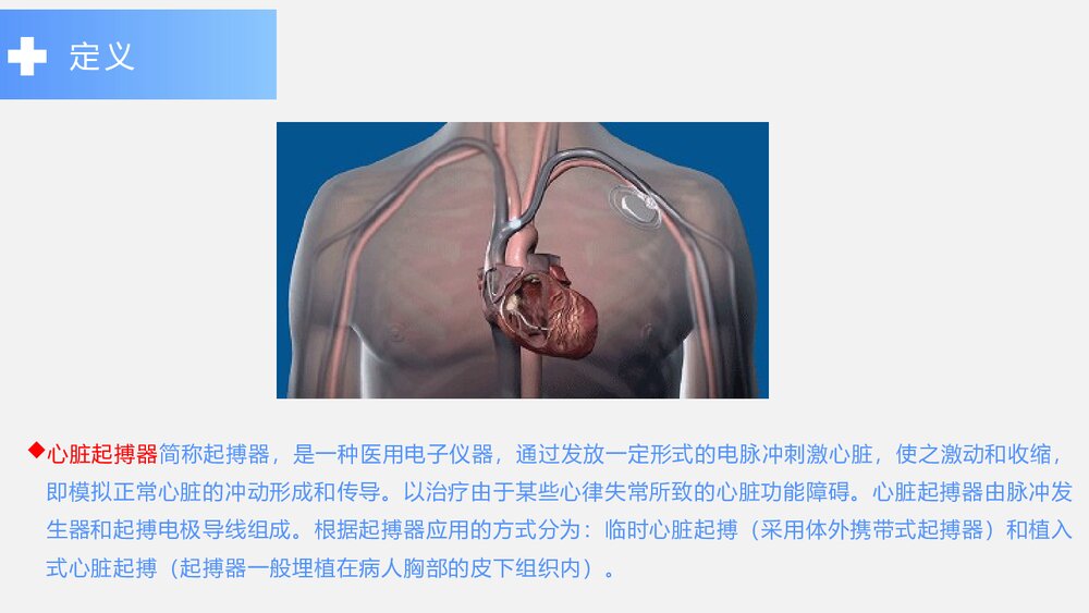 心脏起搏器术后患者的护理PPT课件下载(带内容)3