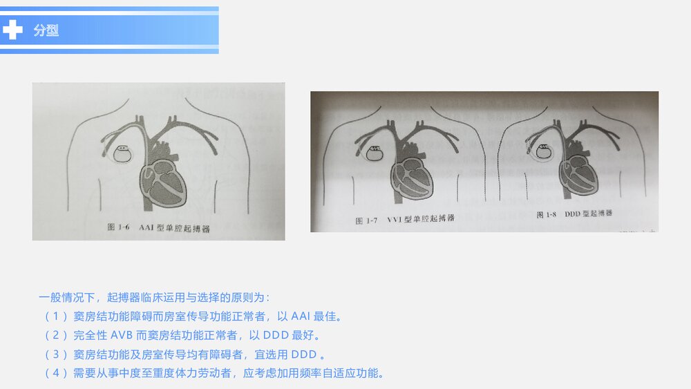 心脏起搏器术后患者的护理PPT课件下载(带内容)5