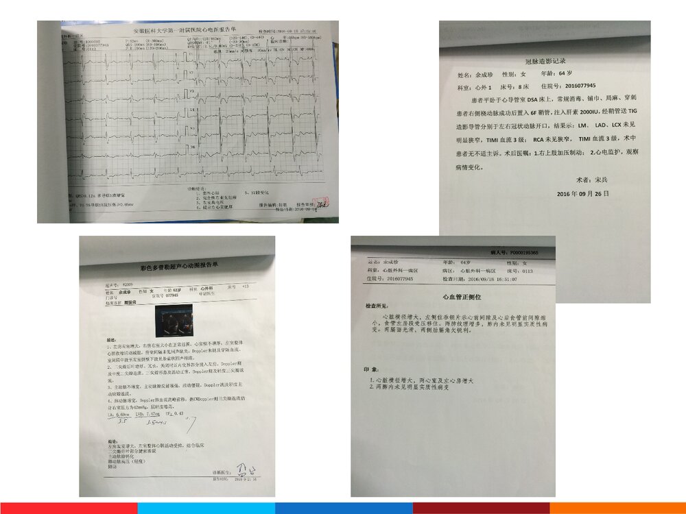 二尖瓣置换+三尖瓣成形术患者护理查房PPT课件7