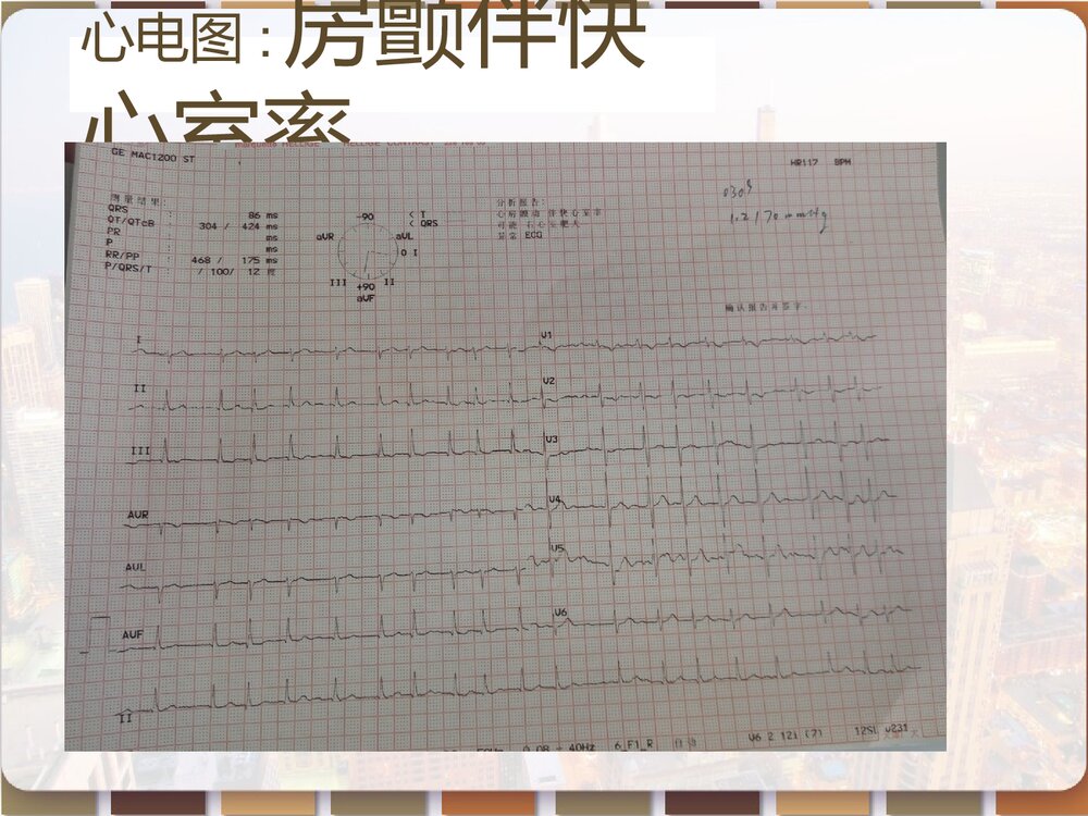 心脏瓣膜病患者的护理查房PPT课件（带内容）9