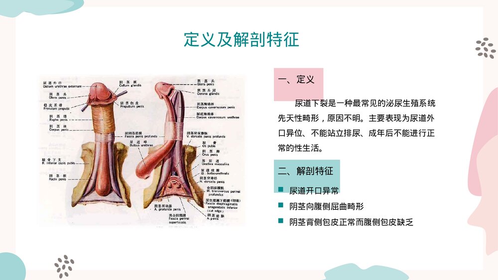 尿道下裂修补术PPT课件（带内容）4