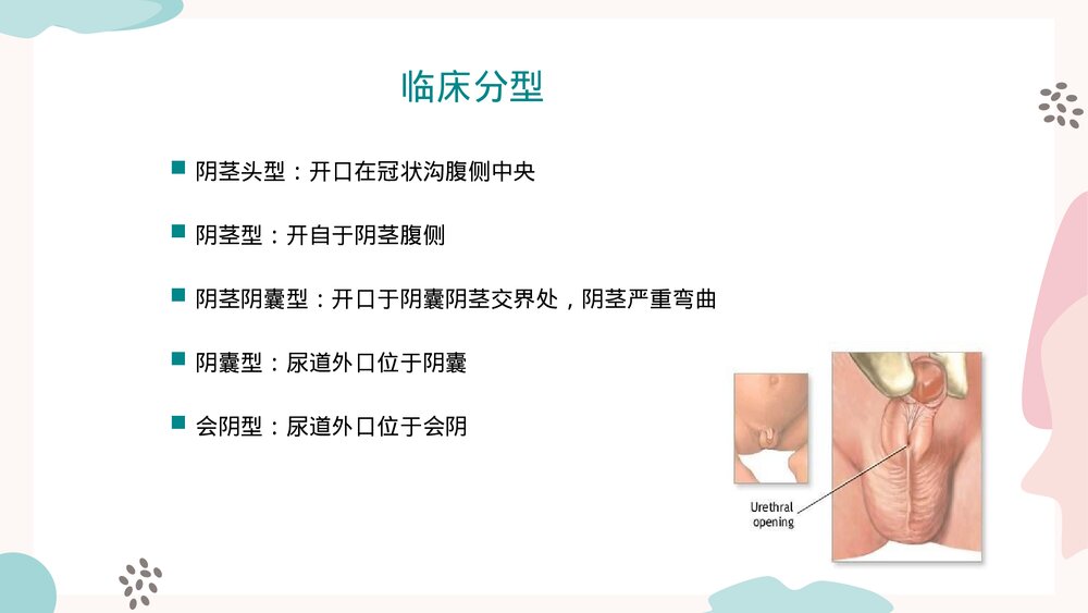 尿道下裂修补术PPT课件（带内容）6